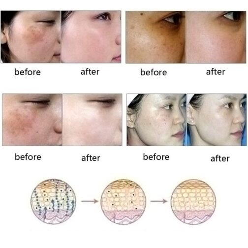Dredge Meridian Skin Care Essence Oil – Natural Acne, Scar & Stretch Mark Removal - Image 5