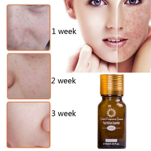 Dredge Meridian Skin Care Essence Oil – Natural Acne, Scar & Stretch Mark Removal - Image 3