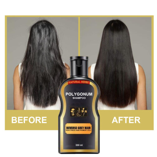 Polygonum Multiflorum Black Hair Shampoo – Natural Plant Ingredients for Healthy, Dark Hair (30ml) - Image 3