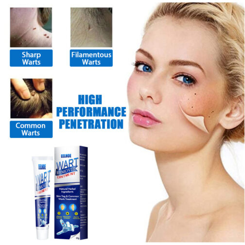 Zhongcao Keyou Liquid Skin Wart Cream – Effective Wart Removal & Skin Care - Image 5