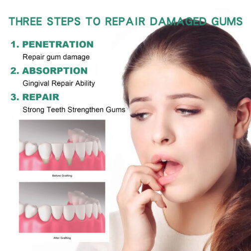 Gum Repair Drops – Periodontal Relief & Oral Care - Image 7
